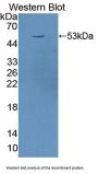 Transferrin Receptor Protein 1 / CD71 (TFRC) Antibody