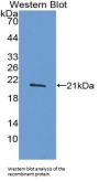 Tumor Necrosis Factor (TNF) Antibody
