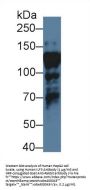 Interleukin Enhancer Binding Factor 3 (ILF3) Antibody