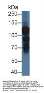 Interleukin Enhancer Binding Factor 3 (ILF3) Antibody