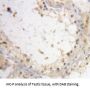 Interleukin Enhancer Binding Factor 3 (ILF3) Antibody