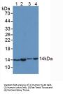 Small Nuclear Ribonucleoprotein Polypeptide D1 (SNRPD1) Antibody