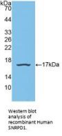 Small Nuclear Ribonucleoprotein Polypeptide D1 (SNRPD1) Antibody