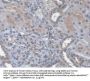 C-X-C Motif Chemokine 14 / BRAK (CXCL14) Antibody