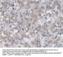 C-X-C Motif Chemokine 14 / BRAK (CXCL14) Antibody