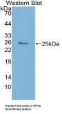 B-Cell CLL/Lymphoma 9 (Bcl9) Antibody