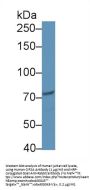 Cancerous Inhibitor Of PP2A Antibody