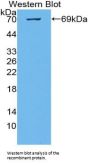 Cancerous Inhibitor Of PP2A Antibody