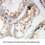 Cancerous Inhibitor Of PP2A Antibody