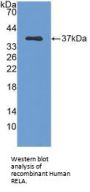 Transcription Factor p65 / NFKB3 (RELA) Antibody