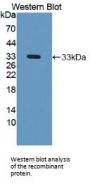 N-Acetyl Alpha-D-Glucosaminidase (NAGLU) Antibody
