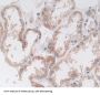 Deoxyribonuclease II (DNASEII) Antibody