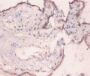 Endoplasmic Reticulum Chaperone BiP (HSPA5) Antibody