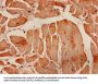 Actin, Alpha Skeletal Muscle (ACTA1) Antibody