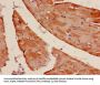 Actin, Alpha Skeletal Muscle (ACTA1) Antibody