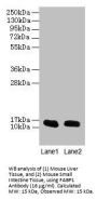 Fatty Acid Binding Protein 1, Liver (FABP1) Antibody