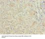 Fatty Acid Binding Protein 1, Liver (FABP1) Antibody