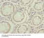 Fatty Acid Binding Protein 1, Liver (FABP1) Antibody