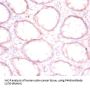 Protein Disulfide-Isomerase / PDI (P4HB) Antibody
