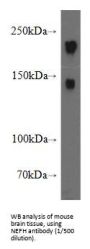 Neurofilament Heavy Polypeptide (NEFH) Antibody
