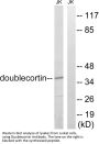 Doublecortin (DCX) Antibody