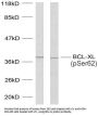 Apoptosis Regulator Bcl-X Phospho-Ser62 (BCL-XL pS62) Antibody