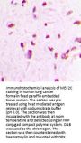 Myocyte-Specific Enhancer Factor 2C (MEF2C) Antibody