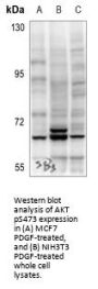 AKT Serine/Threonine Kinase Phospho-Ser473 (AKT pS473) Antibody