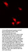 AKT Serine/Threonine Kinase Phospho-Ser473 (AKT pS473) Antibody