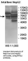 Butyrophilin-Like Protein 2 (BTNL2) Antibody