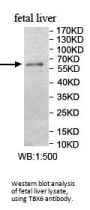 T-Box Protein 6 (TBX6) Antibody
