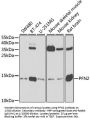 Profilin-2 (PFN2) Antibody