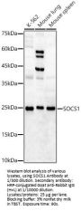 Suppressor of Cytokine Signaling 1 (SOCS1) Antibody