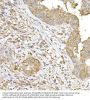 Suppressor of Cytokine Signaling 1 (SOCS1) Antibody