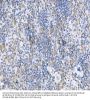 Suppressor of Cytokine Signaling 1 (SOCS1) Antibody