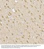 Suppressor of Cytokine Signaling 1 (SOCS1) Antibody