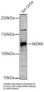 WD Repeat-Containing Protein 6 (WDR6) Antibody