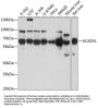 Very Long-Chain Specific Acyl-CoA Dehydrogenase, Mitochondrial (ACADVL) Antibody
