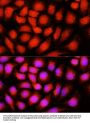 Very Long-Chain Specific Acyl-CoA Dehydrogenase, Mitochondrial (ACADVL) Antibody