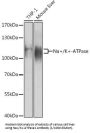 Sodium/Potassium-Transporting ATPase Subunit Alpha 1 (ATP1A1) Antibody