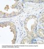 E3 Ubiquitin-Protein Ligase CBL (CBL) Antibody