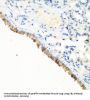 E3 Ubiquitin-Protein Ligase CBL (CBL) Antibody
