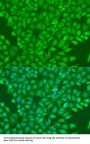E3 Ubiquitin-Protein Ligase CBL (CBL) Antibody