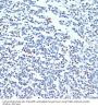 Polypyrimidine Tract-Binding Protein 1 (PTBP1) Antibody
