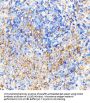 Interleukin 8 Receptor Beta / IL8RB (CXCR2) Antibody