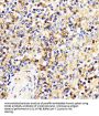 Interleukin 8 Receptor Beta / IL8RB (CXCR2) Antibody