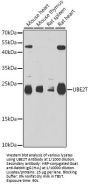Ubiquitin Conjugating Enzyme E2 T (UBE2T) Antibody