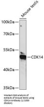 Cyclin-Dependent Kinase 14 (PFTK1) Antibody