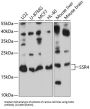 Translocon-Associated Protein Subunit Delta (SSR4) Antibody