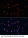 Mitochondrial Import Receptor Subunit TOM70 (TOMM70) Antibody